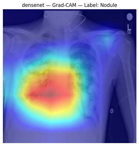 DenseNet Grad-CAM
