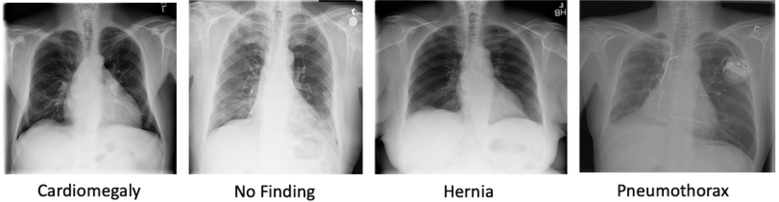 Chest X-ray samples