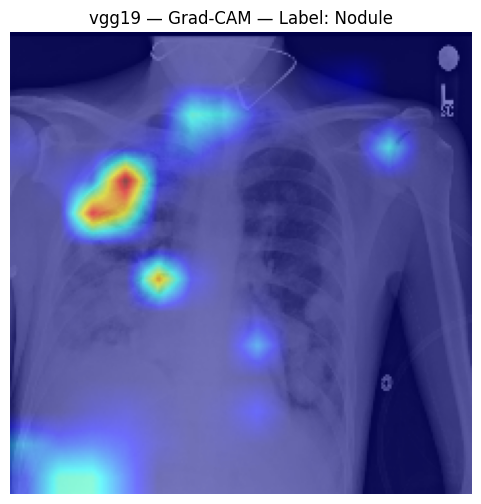 VGG Grad-CAM